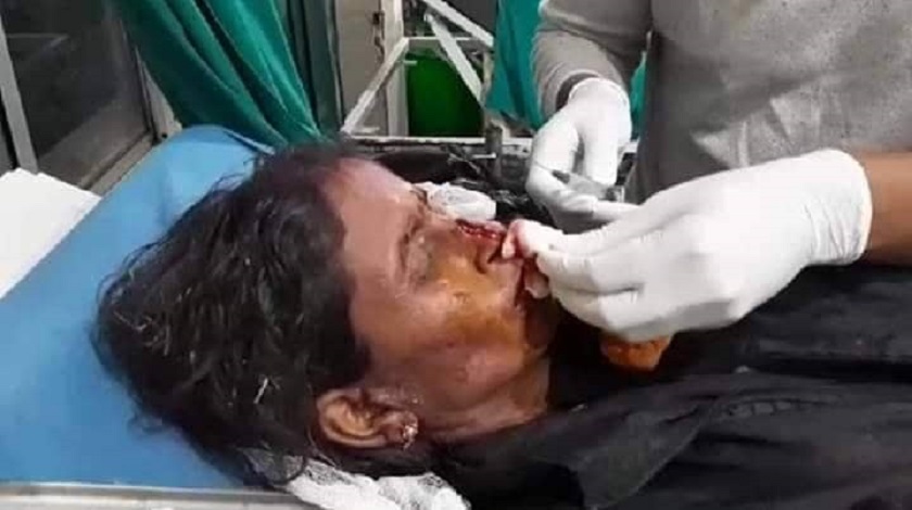 आईतवार आएको भिषण आँधी हुरीमा परेर बारा र पर्सामा ३० जनाको मृत्यु