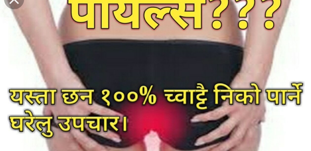 के हो पायल्स? कारण, लक्षण, समस्या र डाक्टरको सुझाव सहित प्राकृतिक उपचार पढ्नुहोस