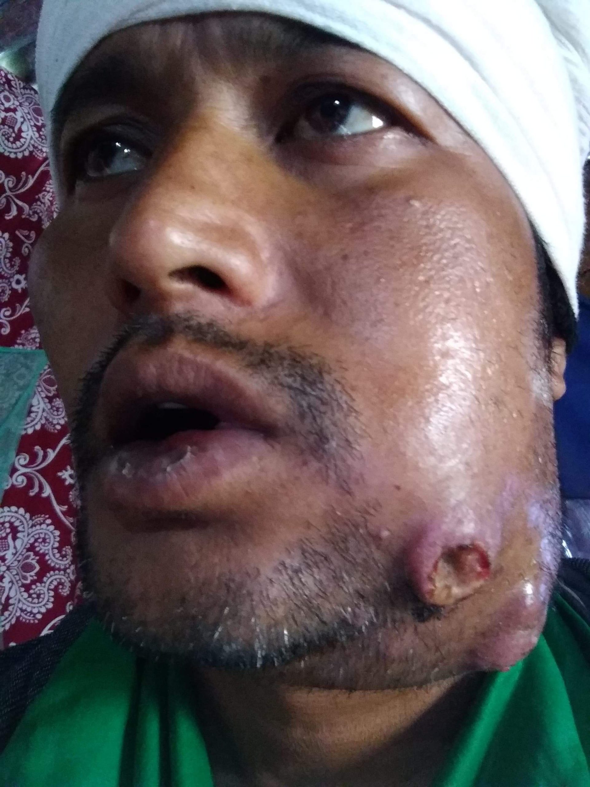 आर्थिक अभाबमा उपचार गर्न नपाएका श्रेष्ठद्वारा सहयोगको अपिल