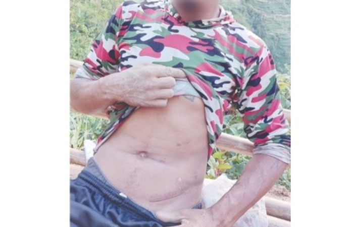नक्कली नागरिकता बनाएर मिर्गाैला तस्करी