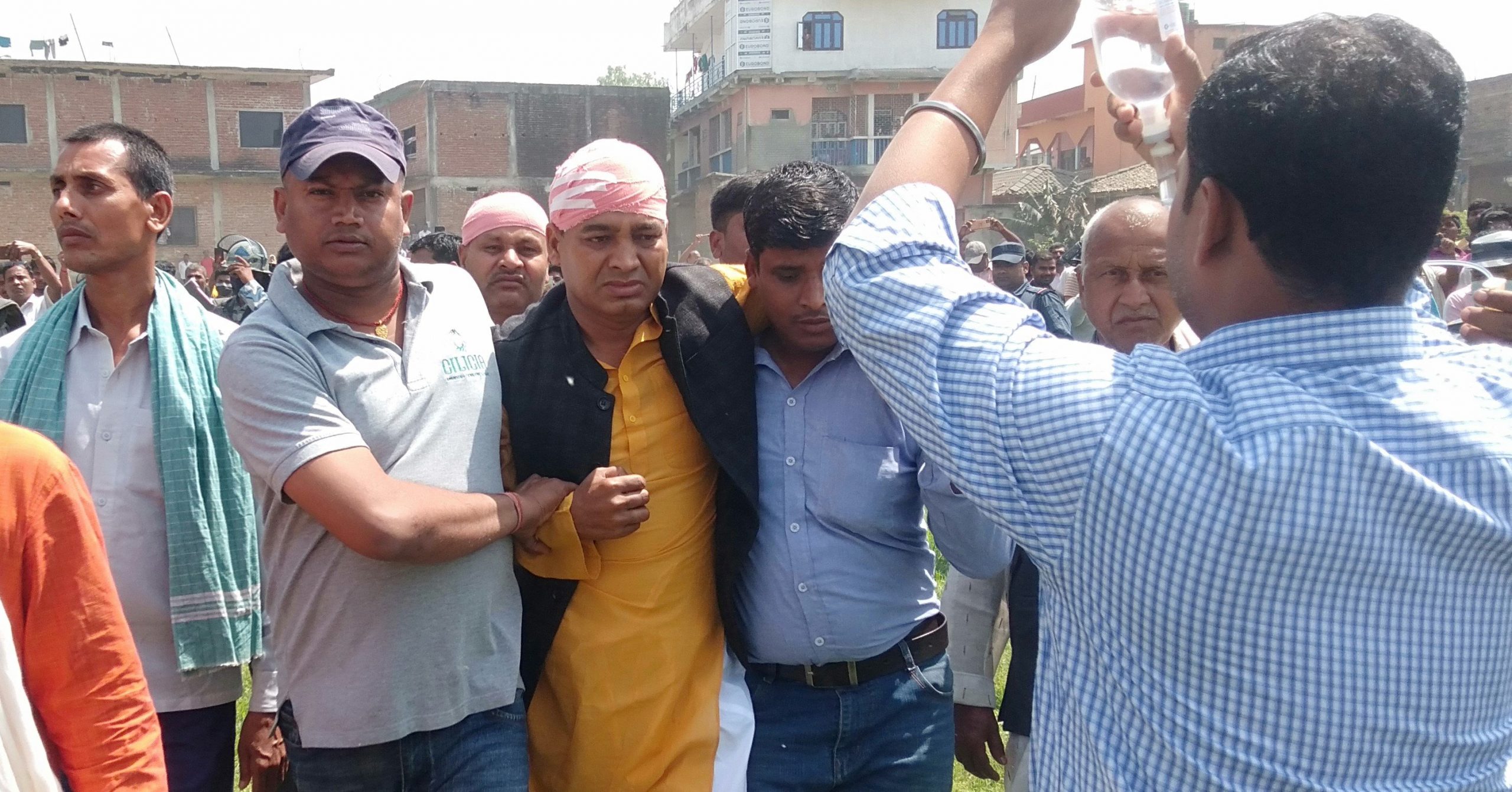 झडपमा घाइते सांसद साहलाई उपचारका लागि काठमाडौंं ल्याइयो